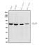 Zeta Chain Of T Cell Receptor Associated Protein Kinase 70 antibody, M00754-4, Boster Biological Technology, Western Blot image 