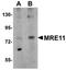 MRE11 Homolog, Double Strand Break Repair Nuclease antibody, orb75333, Biorbyt, Western Blot image 
