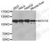 Mov10 RISC Complex RNA Helicase antibody, A3966, ABclonal Technology, Western Blot image 