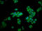 Hexosaminidase Subunit Alpha antibody, LS-C669794, Lifespan Biosciences, Immunofluorescence image 