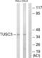 Tumor Suppressor Candidate 3 antibody, LS-C119019, Lifespan Biosciences, Western Blot image 