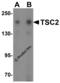 TSC Complex Subunit 2 antibody, 3507, ProSci, Western Blot image 