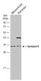 Syntaxin 6 antibody, GTX115375, GeneTex, Western Blot image 