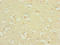 DnaJ Heat Shock Protein Family (Hsp40) Member C19 antibody, LS-C675650, Lifespan Biosciences, Immunohistochemistry paraffin image 
