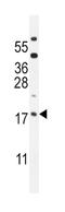 ORMDL Sphingolipid Biosynthesis Regulator 3 antibody, abx025880, Abbexa, Western Blot image 