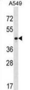 Pentraxin-related protein PTX3 antibody, abx028325, Abbexa, Western Blot image 