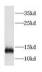 Dynein Light Chain Tctex-Type 3 antibody, FNab02591, FineTest, Western Blot image 
