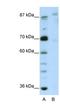 GLIS Family Zinc Finger 3 antibody, NBP1-80416, Novus Biologicals, Western Blot image 
