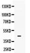 UDP-GlcNAc:BetaGal Beta-1,3-N-Acetylglucosaminyltransferase 8 antibody, PB9686, Boster Biological Technology, Western Blot image 