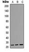 Activation Induced Cytidine Deaminase antibody, LS-C354274, Lifespan Biosciences, Western Blot image 