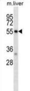 Death Associated Protein Kinase 2 antibody, abx028241, Abbexa, Western Blot image 