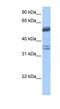 Coilin antibody, NBP1-54669, Novus Biologicals, Western Blot image 