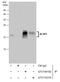 Eukaryotic Translation Initiation Factor 4E Binding Protein 1 antibody, GTX109162, GeneTex, Immunoprecipitation image 