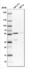 3-Oxoacid CoA-Transferase 1 antibody, NBP1-82462, Novus Biologicals, Western Blot image 