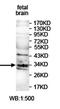 Ankyrin Repeat Domain 45 antibody, orb78100, Biorbyt, Western Blot image 