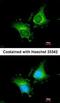 Coagulation Factor XIII A Chain antibody, orb74115, Biorbyt, Immunofluorescence image 
