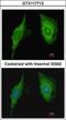 Cysteine Rich Protein 2 antibody, GTX117712, GeneTex, Immunofluorescence image 