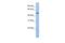 Lysyl Oxidase Like 1 antibody, PA5-44213, Invitrogen Antibodies, Western Blot image 