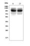 Ubiquitin Protein Ligase E3A antibody, A00582, Boster Biological Technology, Western Blot image 