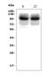 Ubiquitin Protein Ligase E3A antibody, A00582, Boster Biological Technology, Western Blot image 