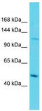 Activating Transcription Factor 7 Interacting Protein antibody, TA342328, Origene, Western Blot image 