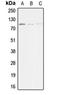 Actinin Alpha 3 (Gene/Pseudogene) antibody, orb213520, Biorbyt, Western Blot image 