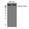 DNA Topoisomerase II Alpha antibody, LS-C381049, Lifespan Biosciences, Western Blot image 