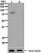 Dishevelled Segment Polarity Protein 2 antibody, ab124933, Abcam, Western Blot image 
