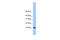 Trafficking Protein Particle Complex 6B antibody, 26-780, ProSci, Enzyme Linked Immunosorbent Assay image 