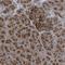 Protein Phosphatase 1 Regulatory Subunit 15A antibody, NBP1-89800, Novus Biologicals, Immunohistochemistry frozen image 