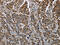 Glutamic-Oxaloacetic Transaminase 2 antibody, CSB-PA147812, Cusabio, Immunohistochemistry paraffin image 