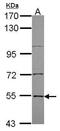 Enhancer Of MRNA Decapping 3 antibody, PA5-22395, Invitrogen Antibodies, Western Blot image 