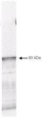 Pyruvate Dehydrogenase Kinase 1 antibody, GTX22495, GeneTex, Western Blot image 