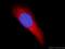 Transmembrane Protein 38B antibody, 19919-1-AP, Proteintech Group, Immunofluorescence image 