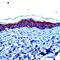 Involucrin antibody, PA5-32454, Invitrogen Antibodies, Immunohistochemistry frozen image 