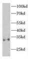 Electron Transfer Flavoprotein Subunit Beta antibody, FNab02876, FineTest, Western Blot image 