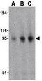 TLR11 antibody, GTX31683, GeneTex, Western Blot image 