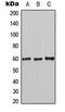MutY DNA Glycosylase antibody, MBS8231872, MyBioSource, Western Blot image 