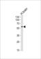 Syncytin antibody, 61-446, ProSci, Western Blot image 