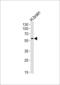 Endogenous Retrovirus Group W Member 1, Envelope antibody, 61-446, ProSci, Western Blot image 