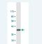 Mitochondrial import inner membrane translocase subunit Tim8 A antibody, H00001678-M02, Novus Biologicals, Western Blot image 