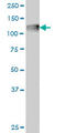 Complement C3 antibody, LS-B4290, Lifespan Biosciences, Western Blot image 