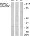 Histone Deacetylase 4 antibody, TA312829, Origene, Western Blot image 