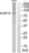 Diacylglycerol Kinase Beta antibody, abx015075, Abbexa, Western Blot image 