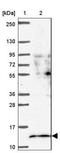 Splicing Factor 3b Subunit 5 antibody, NBP2-13301, Novus Biologicals, Western Blot image 