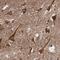 Neurobeachin antibody, PA5-59156, Invitrogen Antibodies, Immunohistochemistry paraffin image 