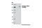 Transforming Acidic Coiled-Coil Containing Protein 3 antibody, 8842P, Cell Signaling Technology, Western Blot image 