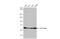 Chaperonin Containing TCP1 Subunit 8 antibody, GTX105725, GeneTex, Western Blot image 
