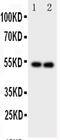 Gamma-Aminobutyric Acid Type A Receptor Alpha1 Subunit antibody, PA5-79291, Invitrogen Antibodies, Western Blot image 