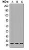 Orosomucoid 1 antibody, MBS8220185, MyBioSource, Western Blot image 